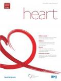Heart《心脏》